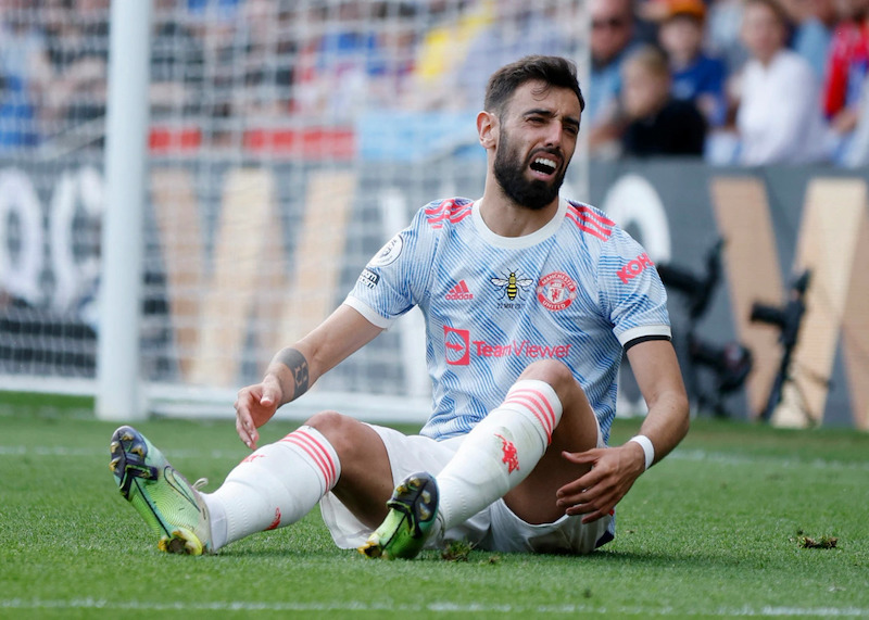 5 vấn đề Ten Hag cần phải giải quyết ngại ở Man United: H&agrave;ng thủ như mơ ngủ! - Ảnh 4