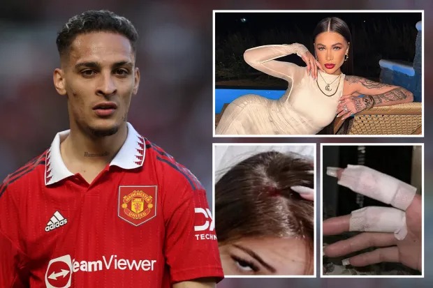 Antony l&ecirc;n tiếng 