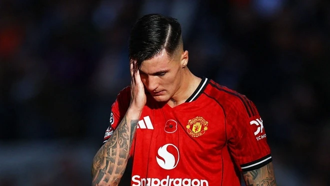 MU tiết lộ t&igrave;nh trạng của Sesko, khiến nhiều người lo lắng - Ảnh 1