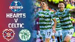 Nhận định Hearts vs Celtic, 21h00 ngày 25/5 (FA Cup Scotland)